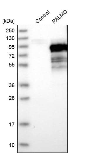 PALMD Antibody - BSA Free Western Blot: PALMD Antibody - BSA Free [NBP1-88481]