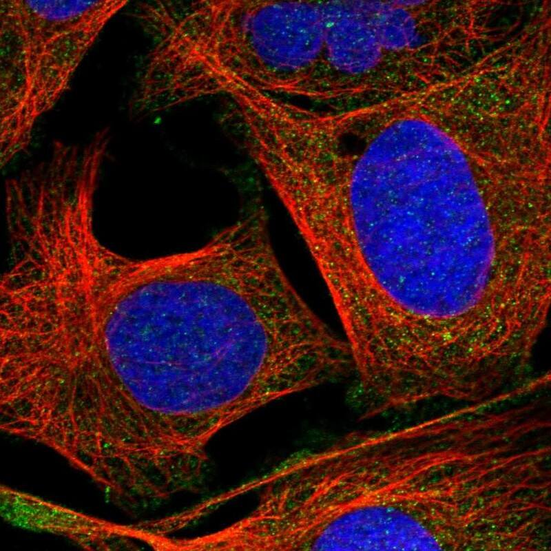 SNAP47 Antibody - BSA Free Immunocytochemistry/ Immunofluorescence: SNAP47 Antibody [NBP1-88483]