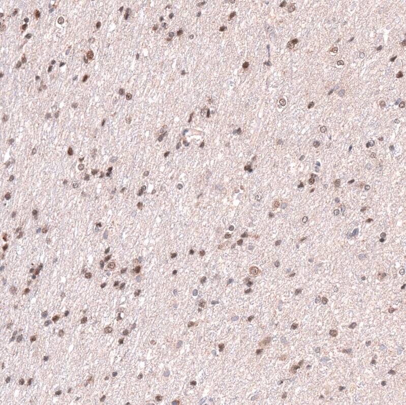 RNF220 Antibody - BSA Free Immunohistochemistry-Paraffin: RNF220 Antibody - BSA Free [NBP1-88487]