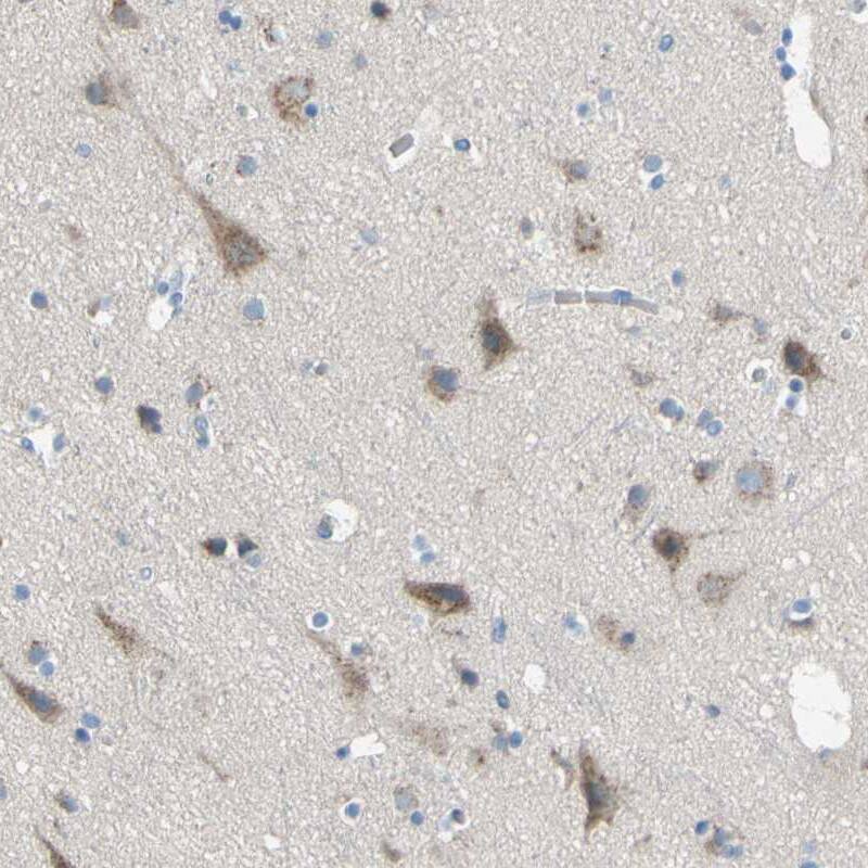 TMEM59L Antibody - BSA Free Immunohistochemistry-Paraffin: TMEM59L Antibody - BSA Free [NBP1-88500]