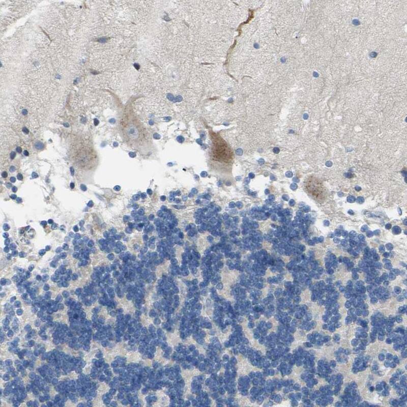 TMEM59L Antibody - BSA Free Immunohistochemistry-Paraffin: TMEM59L Antibody - BSA Free [NBP1-88500]