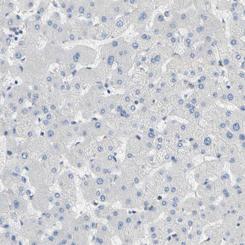 TMEM59L Antibody - BSA Free Immunohistochemistry-Paraffin: TMEM59L Antibody - BSA Free [NBP1-88500]