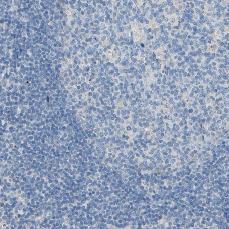 TMEM59L Antibody - BSA Free Immunohistochemistry-Paraffin: TMEM59L Antibody - BSA Free [NBP1-88500]