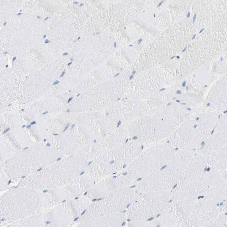 Carboxyl Ester Lipase/CEL Antibody - BSA Free Immunohistochemistry-Paraffin: Carboxyl Ester Lipase/CEL Antibody - BSA Free [NBP1-88502]