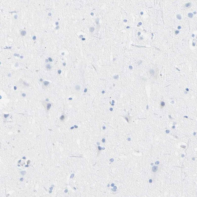Carboxyl Ester Lipase/CEL Antibody - BSA Free Immunohistochemistry-Paraffin: Carboxyl Ester Lipase/CEL Antibody - BSA Free [NBP1-88502]