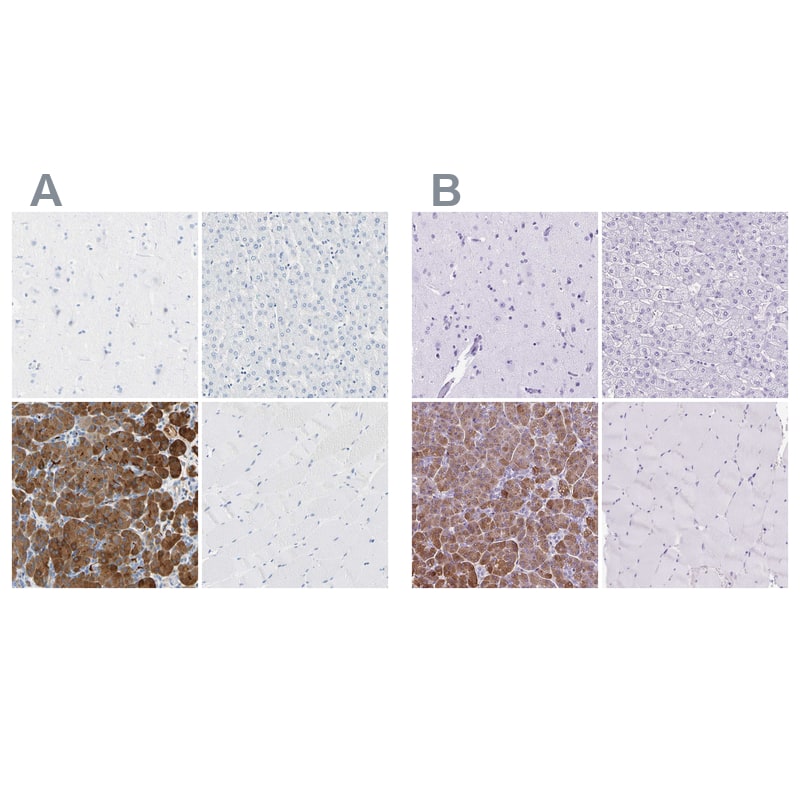Carboxyl Ester Lipase/CEL Antibody - BSA Free Immunohistochemistry-Paraffin: Carboxyl Ester Lipase/CEL Antibody - BSA Free [NBP1-88502]