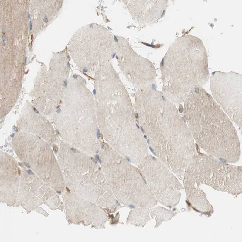 BTN3A3 Antibody - BSA Free Immunohistochemistry-Paraffin: BTN3A3 Antibody [NBP1-88509]