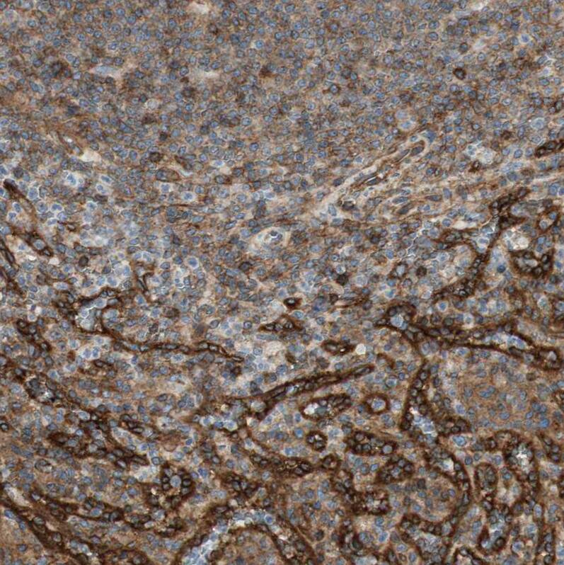 BTN3A3 Antibody - BSA Free Immunohistochemistry-Paraffin: BTN3A3 Antibody [NBP1-88509]