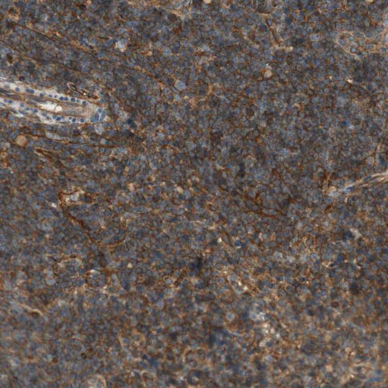BTN3A3 Antibody - BSA Free Immunohistochemistry-Paraffin: BTN3A3 Antibody [NBP1-88509]