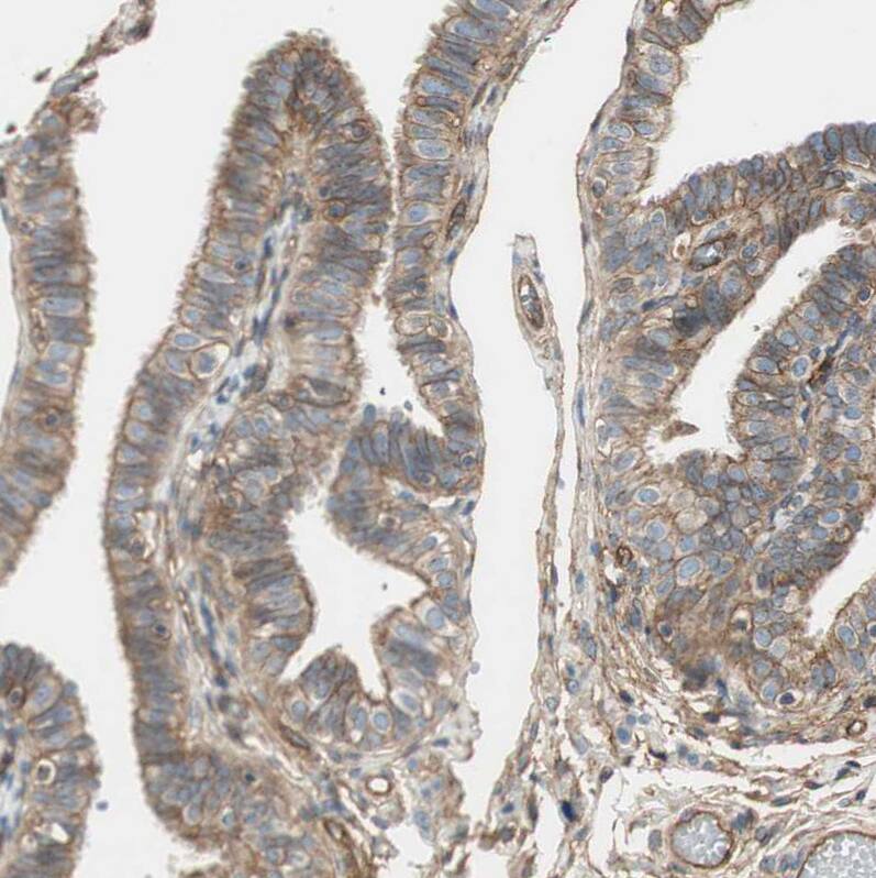 BTN3A3 Antibody - BSA Free Immunohistochemistry-Paraffin: BTN3A3 Antibody [NBP1-88509]