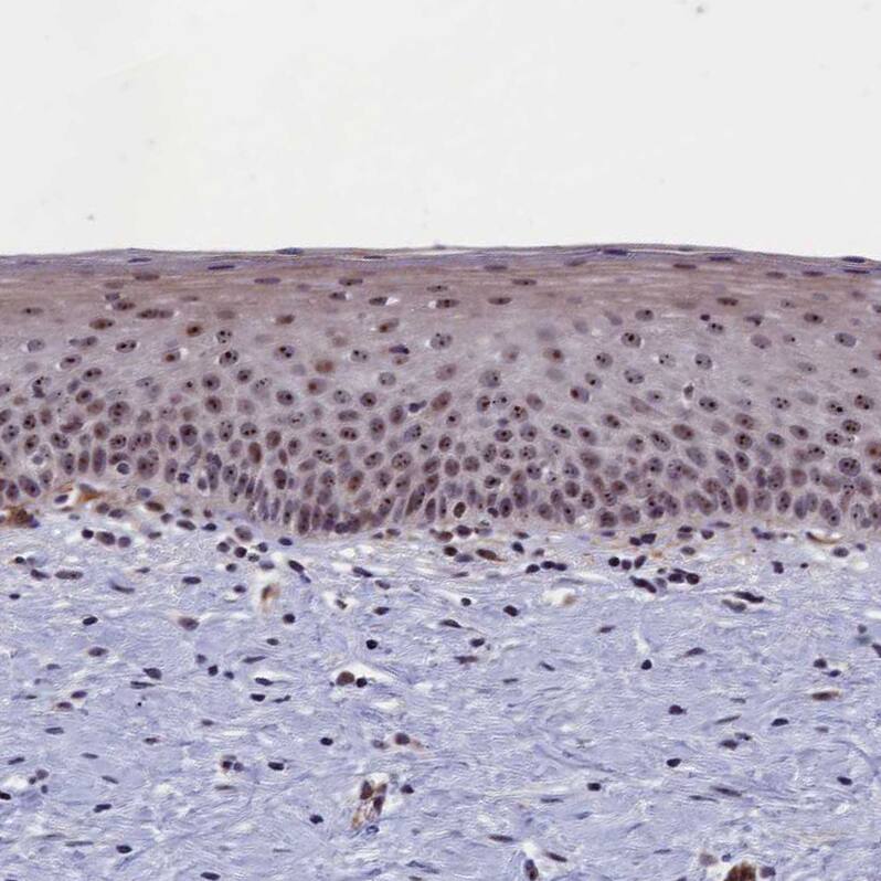 PPAN Antibody - BSA Free Immunohistochemistry-Paraffin: PPAN Antibody - BSA Free [NBP1-88525]