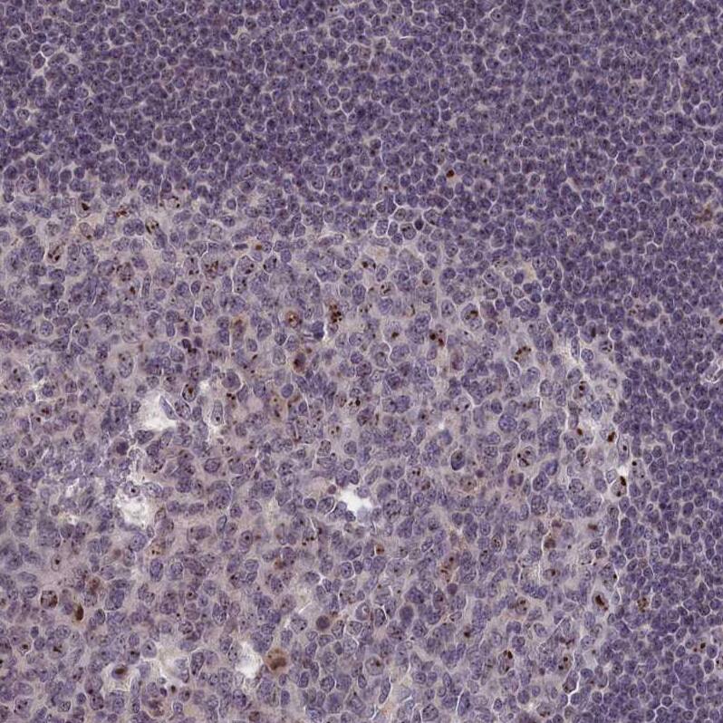 PPAN Antibody - BSA Free Immunohistochemistry-Paraffin: PPAN Antibody - BSA Free [NBP1-88525]
