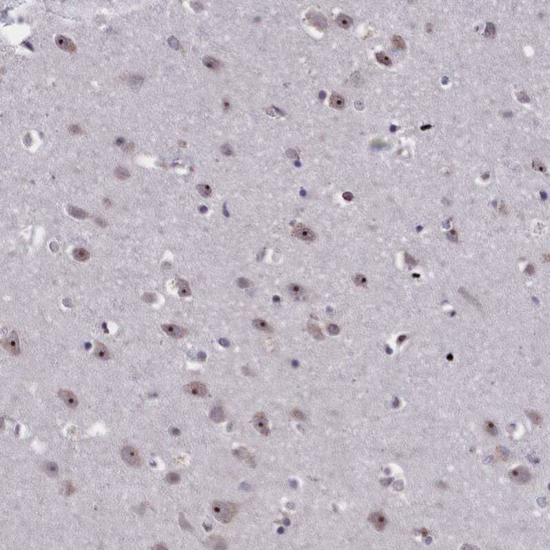 PPAN Antibody - BSA Free Immunohistochemistry-Paraffin: PPAN Antibody - BSA Free [NBP1-88525]