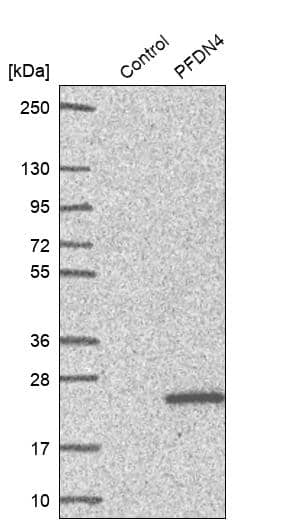 PFDN4 Antibody - BSA Free Western Blot: PFDN4 Antibody - BSA Free [NBP1-88526]