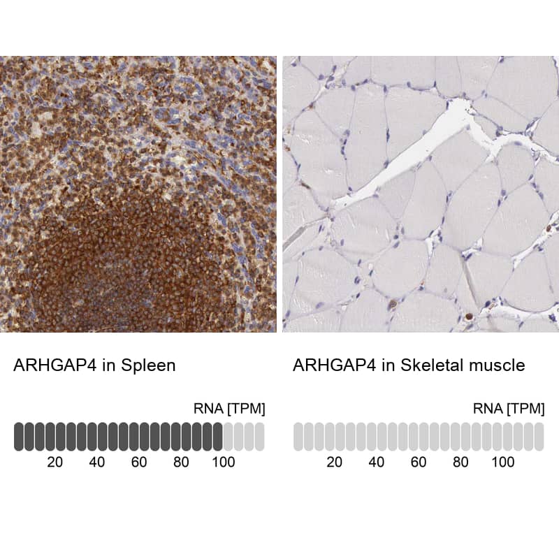 ARHGAP4 Antibody - BSA Free Immunohistochemistry-Paraffin: ARHGAP4 Antibody - BSA Free [NBP1-88527]