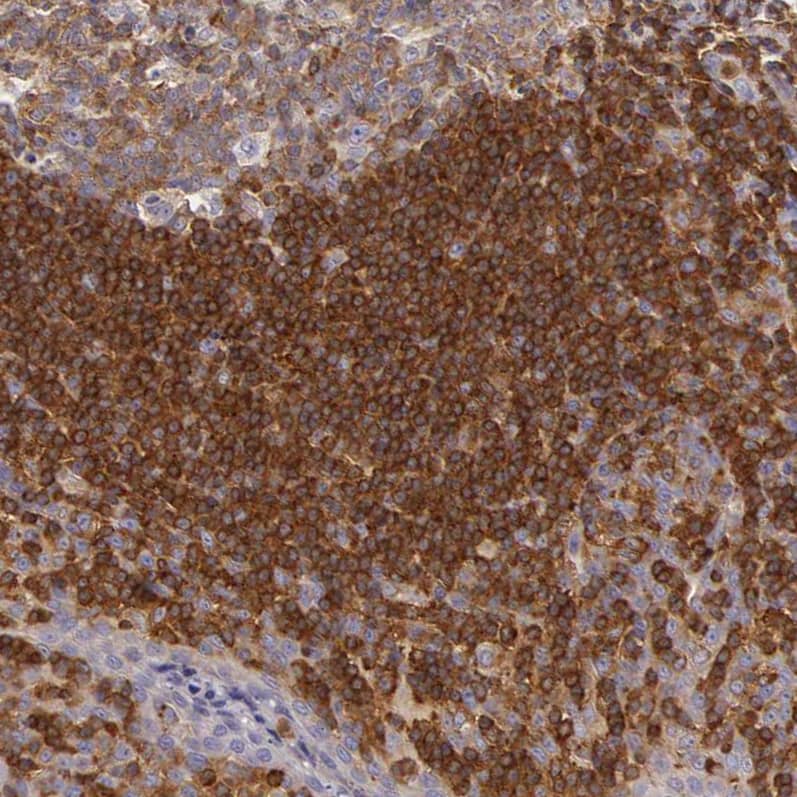 ARHGAP4 Antibody - BSA Free Immunohistochemistry-Paraffin: ARHGAP4 Antibody - BSA Free [NBP1-88527]