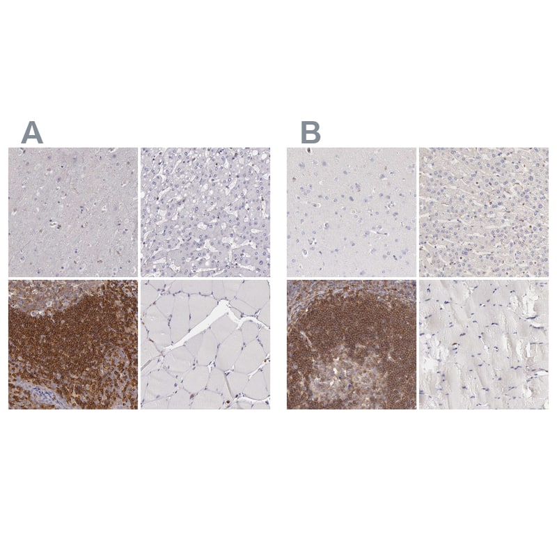 ARHGAP4 Antibody - BSA Free Immunohistochemistry-Paraffin: ARHGAP4 Antibody - BSA Free [NBP1-88527]