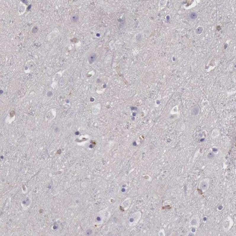 ARHGAP4 Antibody - BSA Free Immunohistochemistry-Paraffin: ARHGAP4 Antibody - BSA Free [NBP1-88527]