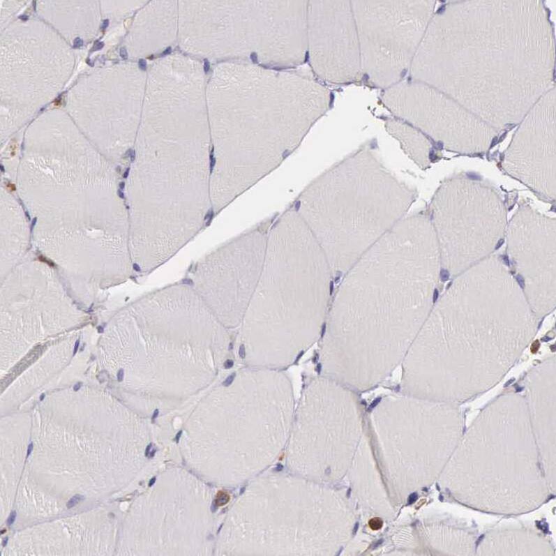 ARHGAP4 Antibody - BSA Free Immunohistochemistry-Paraffin: ARHGAP4 Antibody - BSA Free [NBP1-88527]