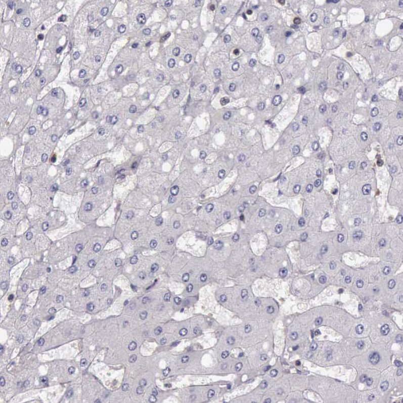 ARHGAP4 Antibody - BSA Free Immunohistochemistry-Paraffin: ARHGAP4 Antibody - BSA Free [NBP1-88527]