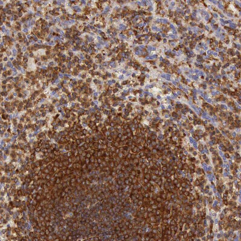 ARHGAP4 Antibody - BSA Free Immunohistochemistry-Paraffin: ARHGAP4 Antibody - BSA Free [NBP1-88527]