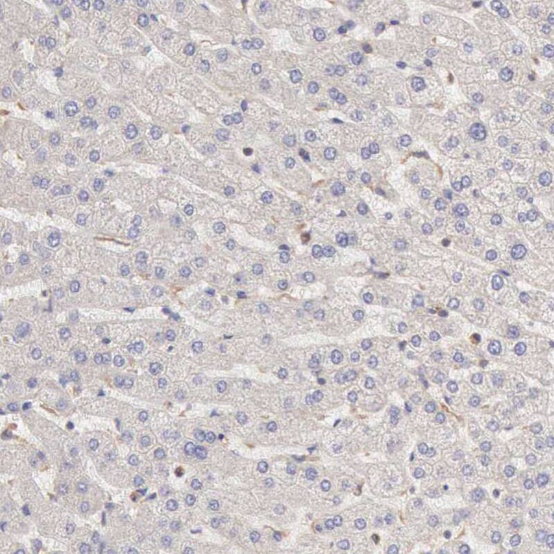 ARHGAP4 Antibody - BSA Free Immunohistochemistry-Paraffin: ARHGAP4 Antibody - BSA Free [NBP1-88528]