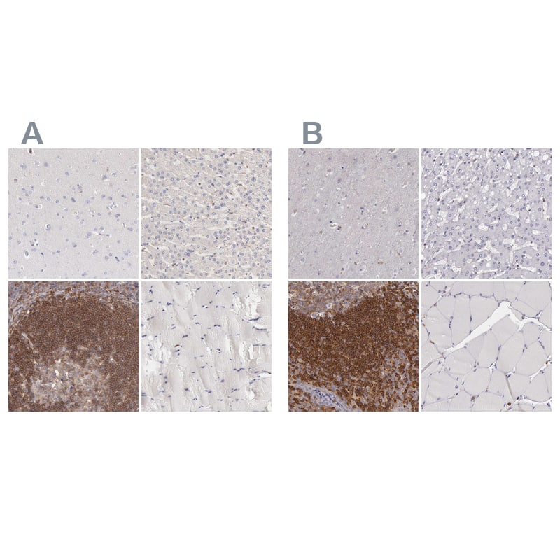 ARHGAP4 Antibody - BSA Free Immunohistochemistry-Paraffin: ARHGAP4 Antibody - BSA Free [NBP1-88528]