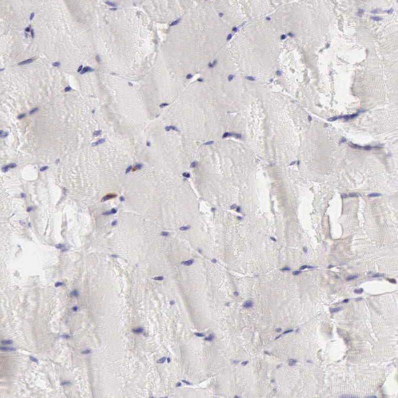 ARHGAP4 Antibody - BSA Free Immunohistochemistry-Paraffin: ARHGAP4 Antibody - BSA Free [NBP1-88528]