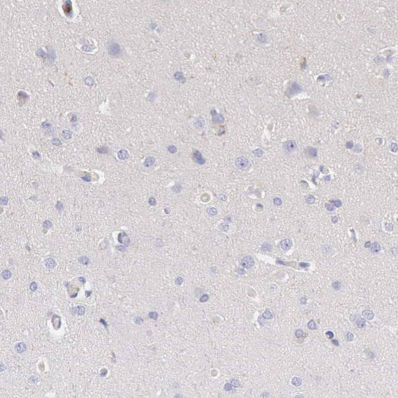 ARHGAP4 Antibody - BSA Free Immunohistochemistry-Paraffin: ARHGAP4 Antibody - BSA Free [NBP1-88528]