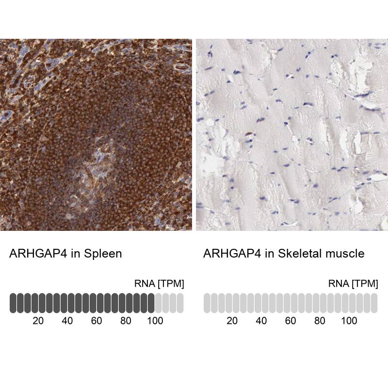 ARHGAP4 Antibody - BSA Free Immunohistochemistry-Paraffin: ARHGAP4 Antibody - BSA Free [NBP1-88528]