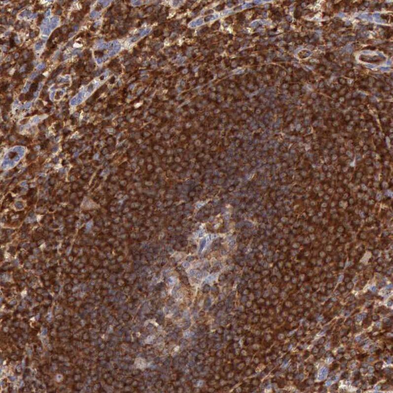 ARHGAP4 Antibody - BSA Free Immunohistochemistry-Paraffin: ARHGAP4 Antibody - BSA Free [NBP1-88528]