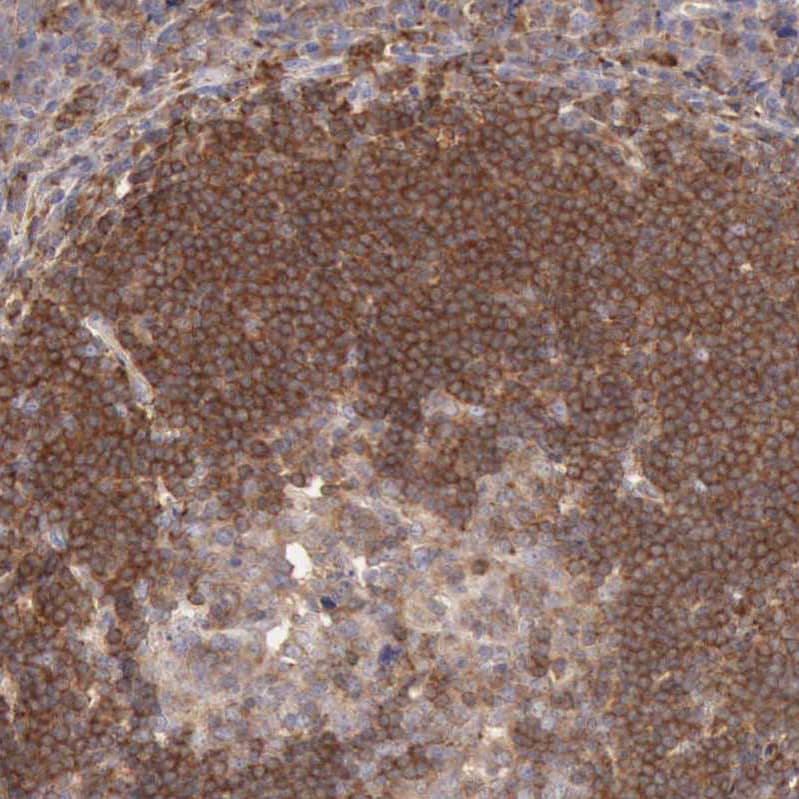 ARHGAP4 Antibody - BSA Free Immunohistochemistry-Paraffin: ARHGAP4 Antibody - BSA Free [NBP1-88528]