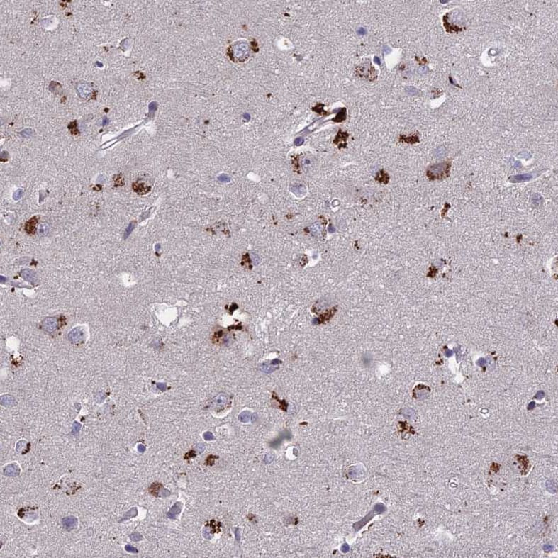 ADO Antibody - BSA Free Immunohistochemistry-Paraffin: ADO Antibody - BSA Free [NBP1-88530]