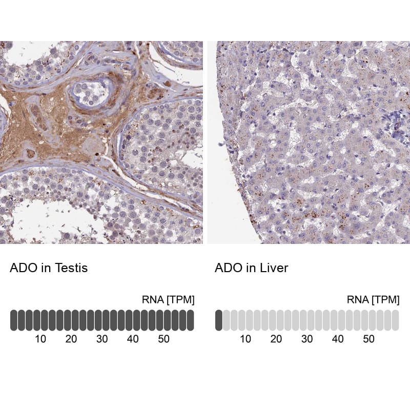ADO Antibody - BSA Free Immunohistochemistry-Paraffin: ADO Antibody - BSA Free [NBP1-88530]