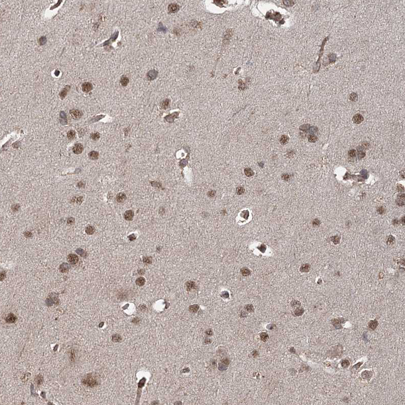 ZCCHC24 Antibody - BSA Free Immunohistochemistry-Paraffin: ZCCHC24 Antibody - BSA Free [NBP1-88536]