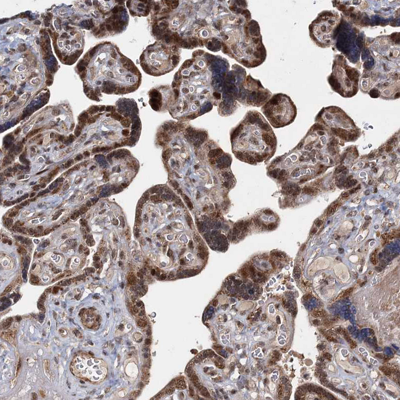 ZCCHC24 Antibody - BSA Free Immunohistochemistry-Paraffin: ZCCHC24 Antibody - BSA Free [NBP1-88536]