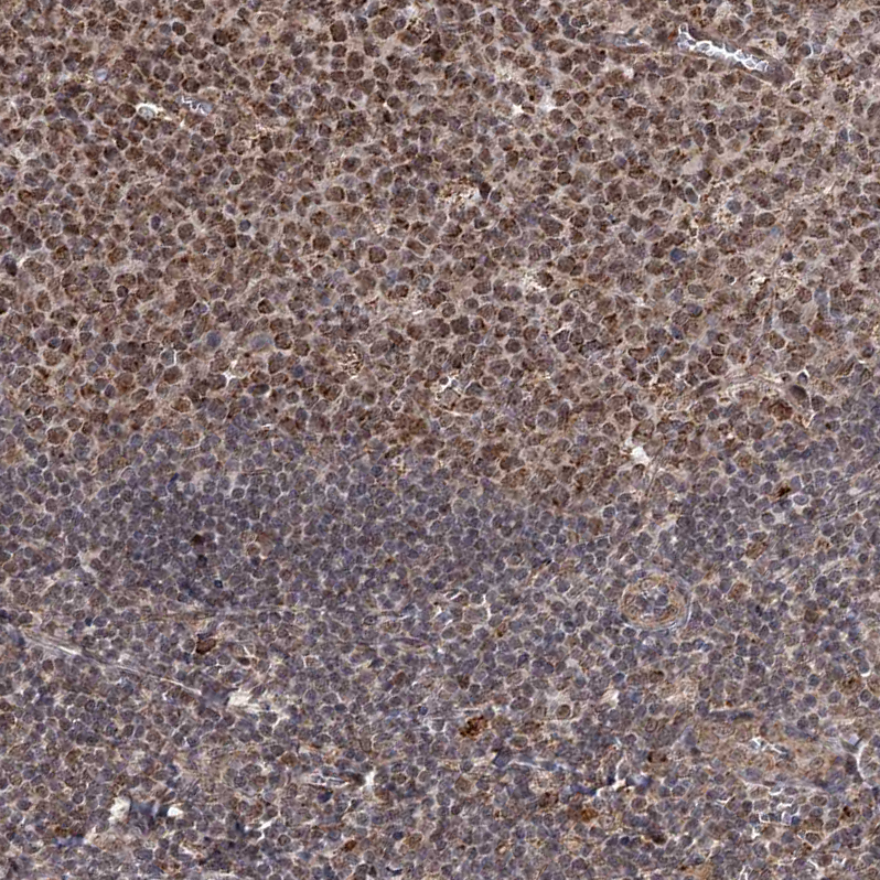 ZCCHC24 Antibody - BSA Free Immunohistochemistry-Paraffin: ZCCHC24 Antibody - BSA Free [NBP1-88536]