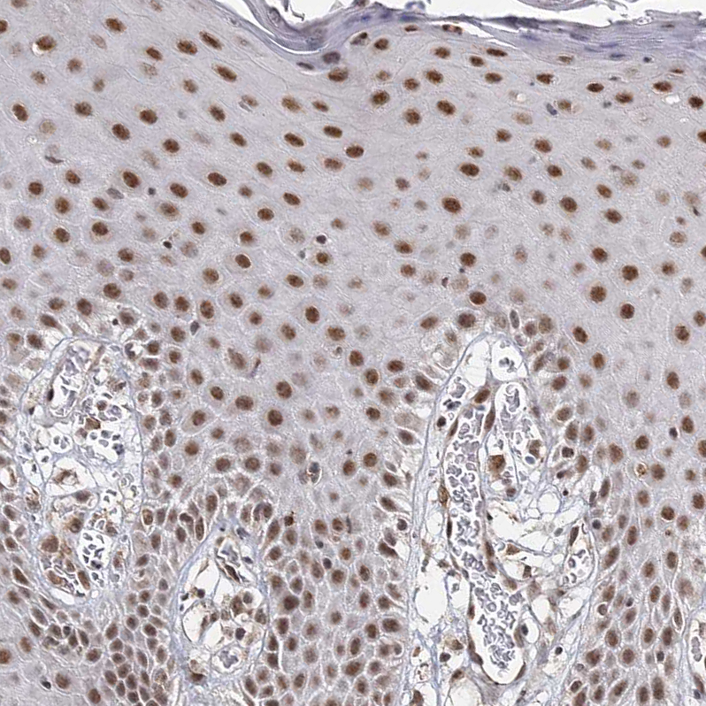 ZCCHC24 Antibody - BSA Free Immunohistochemistry-Paraffin: ZCCHC24 Antibody - BSA Free [NBP1-88536]