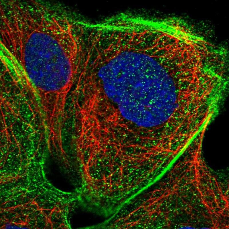 PSTK Antibody - BSA Free Immunocytochemistry/ Immunofluorescence: PSTK Antibody [NBP1-88541]