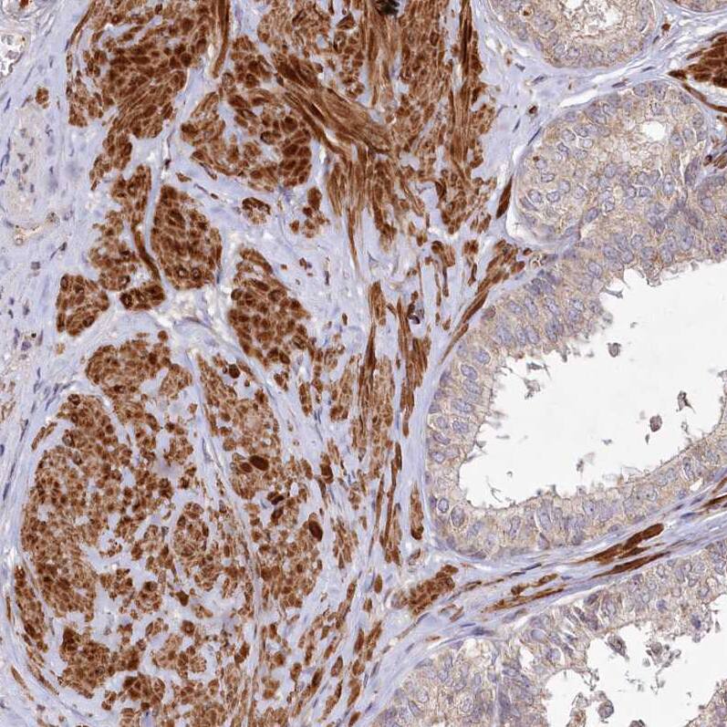 PSTK Antibody - BSA Free Immunohistochemistry-Paraffin: PSTK Antibody - BSA Free [NBP1-88541]