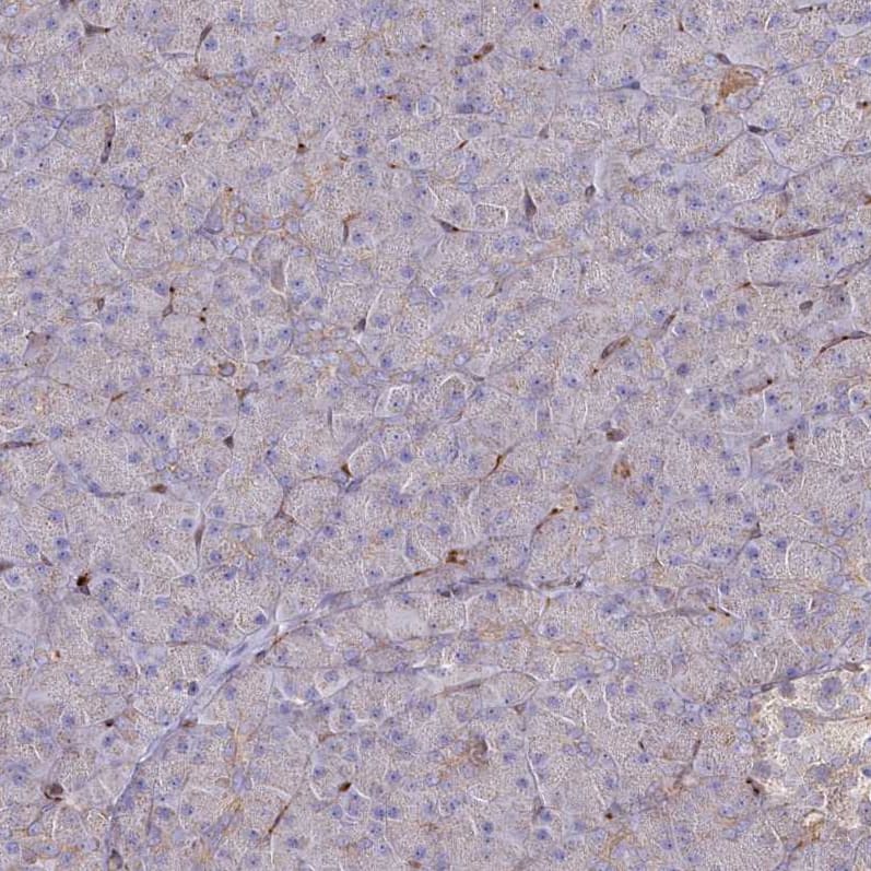PSTK Antibody - BSA Free Immunohistochemistry-Paraffin: PSTK Antibody - BSA Free [NBP1-88541]