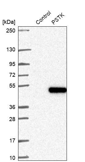 PSTK Antibody - BSA Free Western Blot: PSTK Antibody - BSA Free [NBP1-88541]