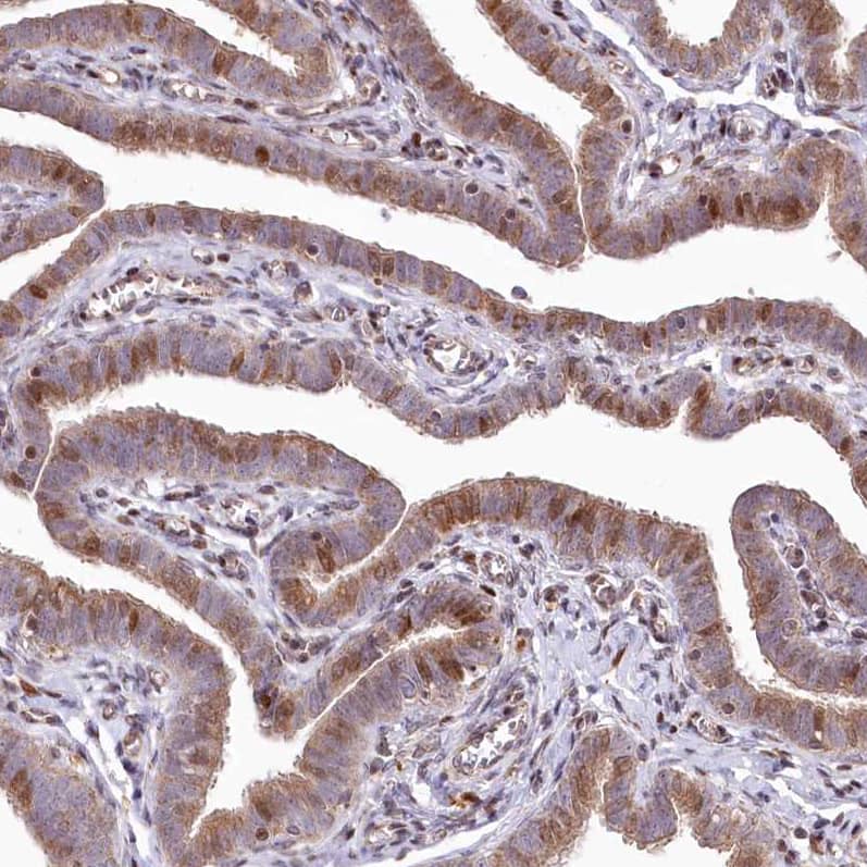 PSTK Antibody - BSA Free Immunohistochemistry-Paraffin: PSTK Antibody - BSA Free [NBP1-88541]