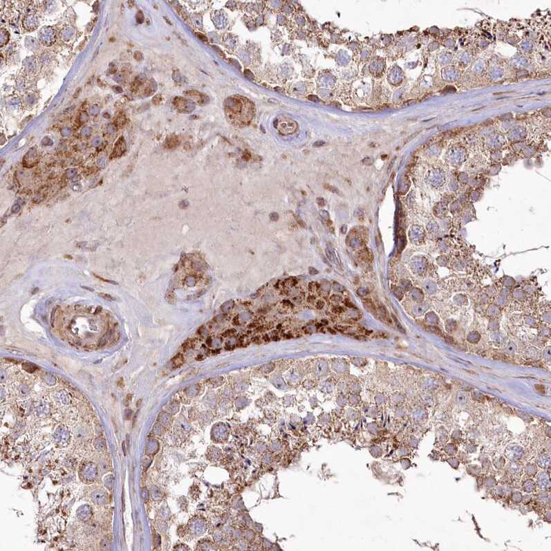 PSTK Antibody - BSA Free Immunohistochemistry-Paraffin: PSTK Antibody - BSA Free [NBP1-88541]