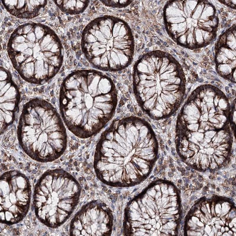 MINDY3 Antibody - BSA Free Immunohistochemistry-Paraffin: MINDY3 Antibody - BSA Free [NBP1-88543]