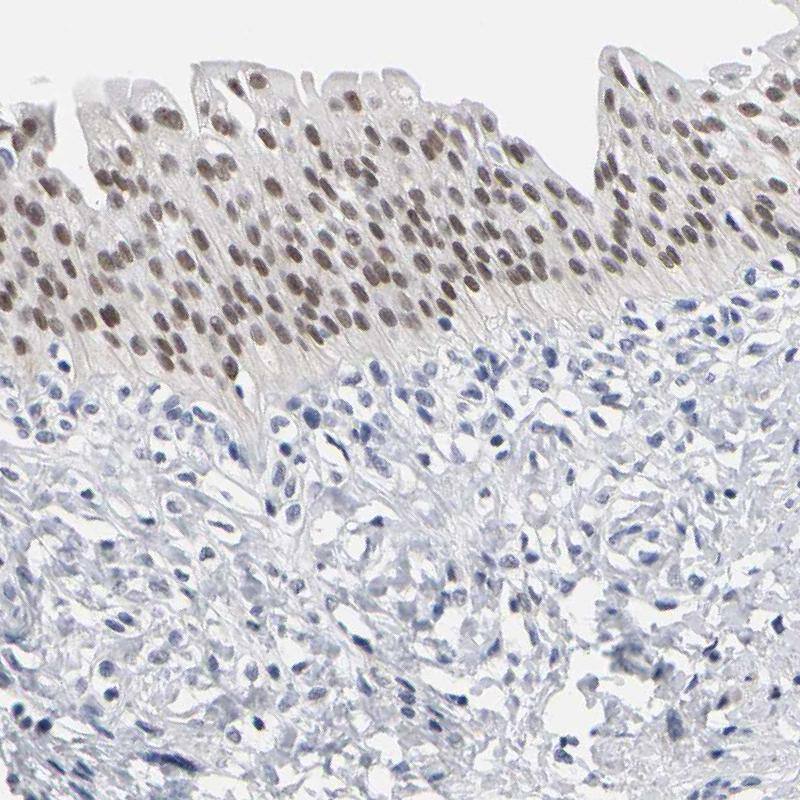 GRHL2 Antibody - BSA Free Immunohistochemistry-Paraffin: GRHL2 Antibody - BSA Free [NBP1-88552]