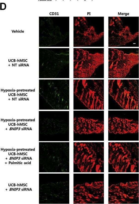 BNIP3L Antibody