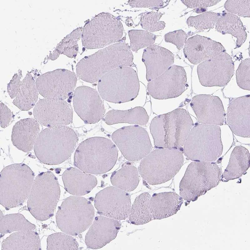 MBP-1 Antibody - BSA Free Immunohistochemistry-Paraffin: MBP-1 Antibody [NBP1-88573]