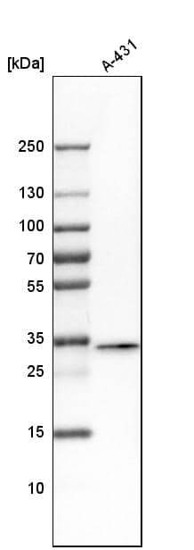 FAM49B Antibody - BSA Free Western Blot: FAM49B Antibody - BSA Free [NBP1-88582]