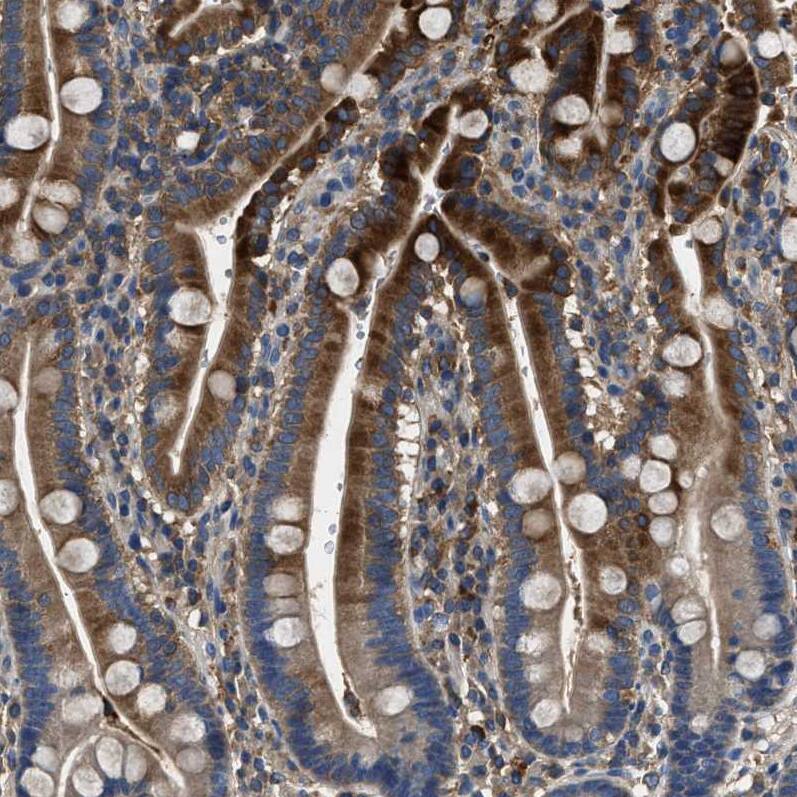 BLOC1S1 Antibody Immunohistochemistry-Paraffin: TRIM26 Antibody [NBP1-88583]